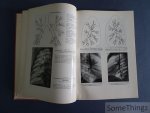 M.A. Lassrich, R. Prévot, K.H. Schäfer. - Pädiatrischer Röntgenatlas. Eine Sammlung typischer Bilder. M.A. Lassrich, R. Prévot, K.H. Schäfer. - Pädiatrischer Röntgenatlas. Eine Sammlung typischer Bilder.