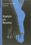Putten , Margreet van . & Ingrid Ruys . [ isbn 9789080073739 ] - Voeten en Reuma . ( In dit boek krijg je antwoord op de vraag wat reuma is en welke aandoeningen zich (kunnen) voordoen. De voet staat centraal. In heldere bewoordingen worden behandeld: wekedelenreuma, nagel– en huidproblemen en afwijkingen in  -