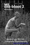 Saskia van Werven  /  Renate Diks / PETER STEVENS FOTOGRAFIE - MS Ont-bloot 2   **De opbrengst van de in Belgie verkochte boeken gaat naar IMSO-Melsbroek