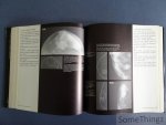 A. Willemin. - Mammographic appearances. / Les images mammographiques. A. Willemin. - Mammographic appearances. / Les images mammographiques.