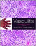 Ball, Gene V. - Vasculitis
