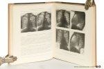 Laubry, Ch. / P. Cottenot / D. Routier / R. Heim de Balsac. - Radiologie clinique du coeur et des gros vaisseaux.