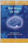 Frank Wijnen - Het brein te kijk Frank Wijnen - Het brein te kijk