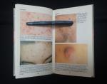 Cunliffe, William J. - A Pocket Guide to Acne