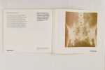 Lorenz, Dieter - Anaclyfen. Stereo-afbeeldingen rond kunst, wetenschap en techniek + uitnodiging (3 foto's)