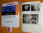 Meng Law, Peter M. Som, Thomas P. Naidich - Problem Solving in Neuroradiology [First edition, 2011]
