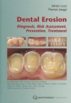 Adrian Lussi, Thomas Jaeggi - Dental Erosion