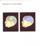Posner, Michael i. & Marcus E. Raichle - beelden in ons brein