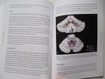 K.M. van Baarsen - The anatomical substrate of cerebellar mutism - Back to basics