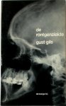 Gust Gils 10522 - De röntgenziekte Paraproza II