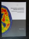Ossenkoppele, Rik - Visualizing Alzheimer’s Disease Pathology, Implementation of amyloid PET in clinical pratise, Proefschrift VU