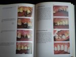 Grundy, J.R. - A Colour Atlas of Conservative Dentistry