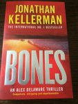 Jonathan Kellerman - Bones