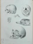 Willem Vrolik - De Vrucht van den mensch en van de zoogdieren afgebeeld en beschreven in hare regelmatige en onregelmatige ontwikkeling, door W. Vrolik ... Tabulae ad illustrandam embryogenesin hominis et mammalium tam naturalem quam abnormen, auctore W. Vrolik