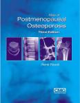 Rizzoli, René - Atlas of Postmenopausal Osteoporosis. Third Edition.