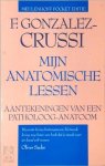 F. Gonzalez-Crussi - Mijn anatomische lessen: aantekeningen van een patholoog-anatoom
