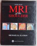 Zlatkin, Michael B. - MRI of the Shoulder [ isbn 9780781715904 ]