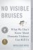 No Visible Bruises: What We...
