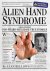 Alien Hand Syndrome