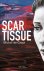 Scar Tissue