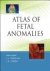 Atlas of Fetal Anomalies