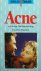 Spreekuur thuis - Acne, een...