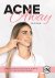 Iris De Jong - Acne Away - #1 Acneverzorging Boek - Vaarwel Puistjes, Mee-eters & Overbodige Dagcremes - Puisten Verwijderaar