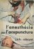 L'Anesthésie par l'Acupuncture
