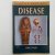 Filer, Joyce - Disease